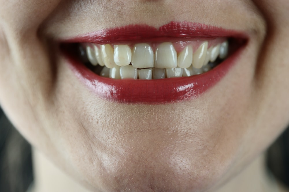 A woman with healthy teeth