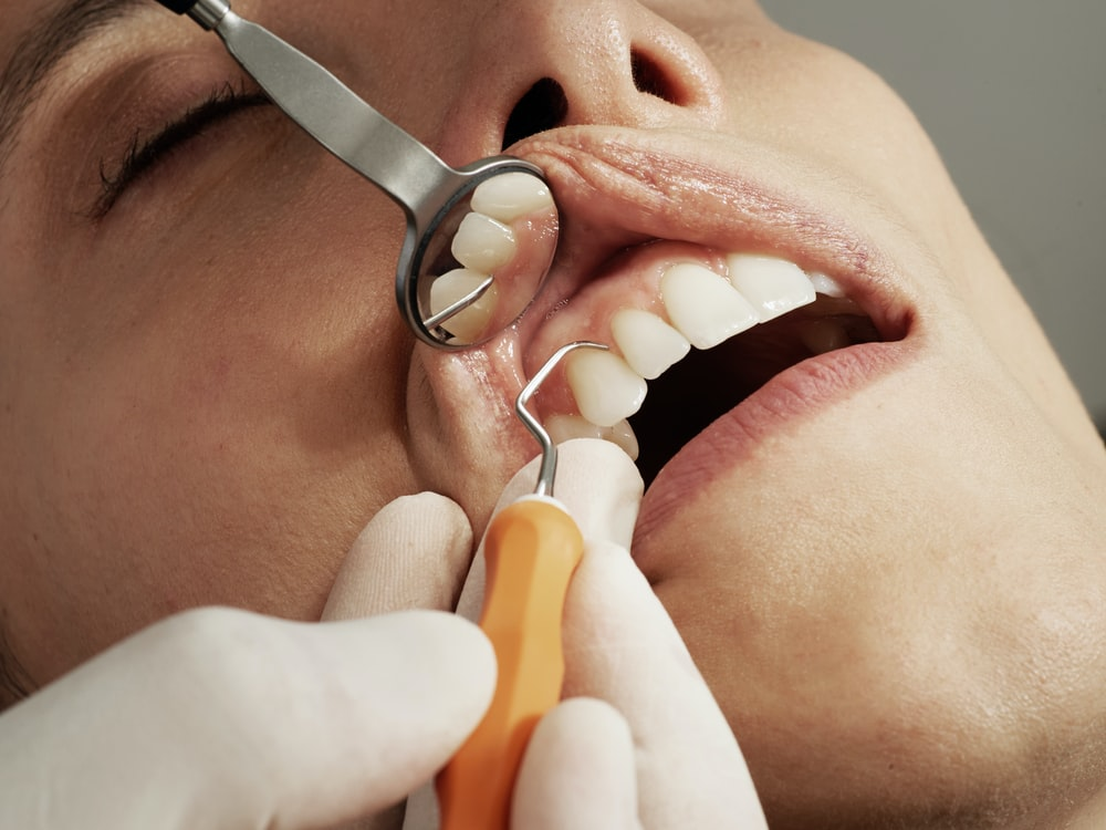 A dentist checking a patient’s teeth